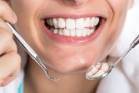 چگونه طول عمر لمینت دندان را افزایش دهیم؟