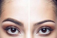 کاشت ابرو چگونه انجام میشود؟