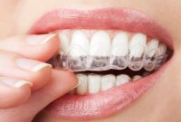 چگونه اسنپ آن اسمایل کار می‌کند؟