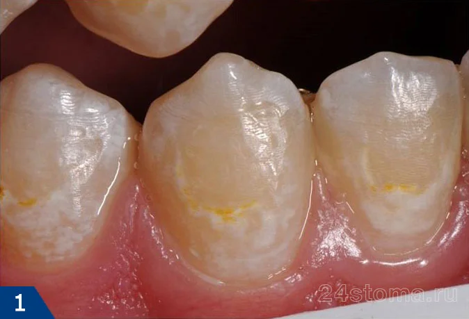 بررسی بهترین خمیر دندانهای ایرانی و خارجی: گزینههای برتر در بازار بررسی بهترین خمیر دندانهای ایرانی و خارجی: گزینههای برتر در بازار