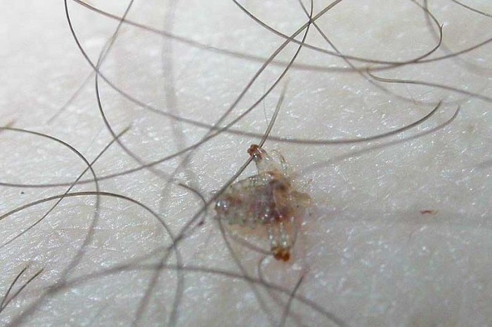 رازهای سفید شدن موهای ناحیه تناسلی رازهای سفید شدن موهای ناحیه تناسلی