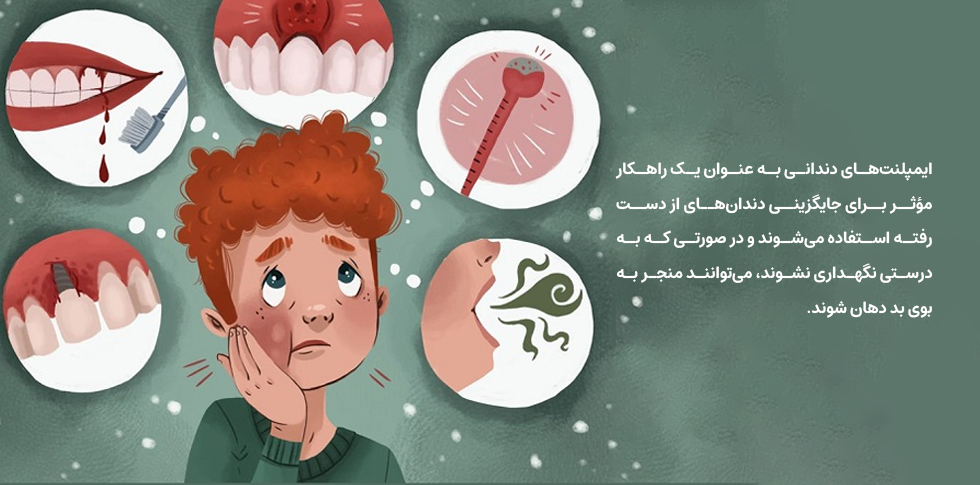 آیا ایمپلنت دندان باعث بوی بد دهان می‌شود؟