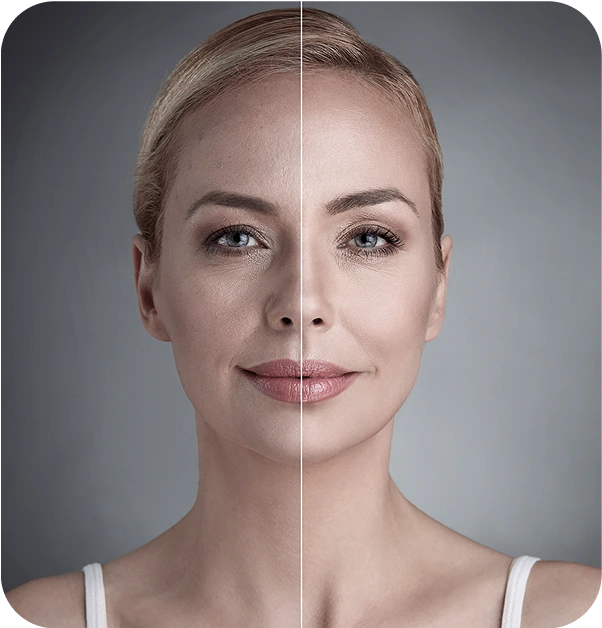 اندولیفت: انقلابی در جوانسازی پوست یا روشی با ابهامات پنهان؟