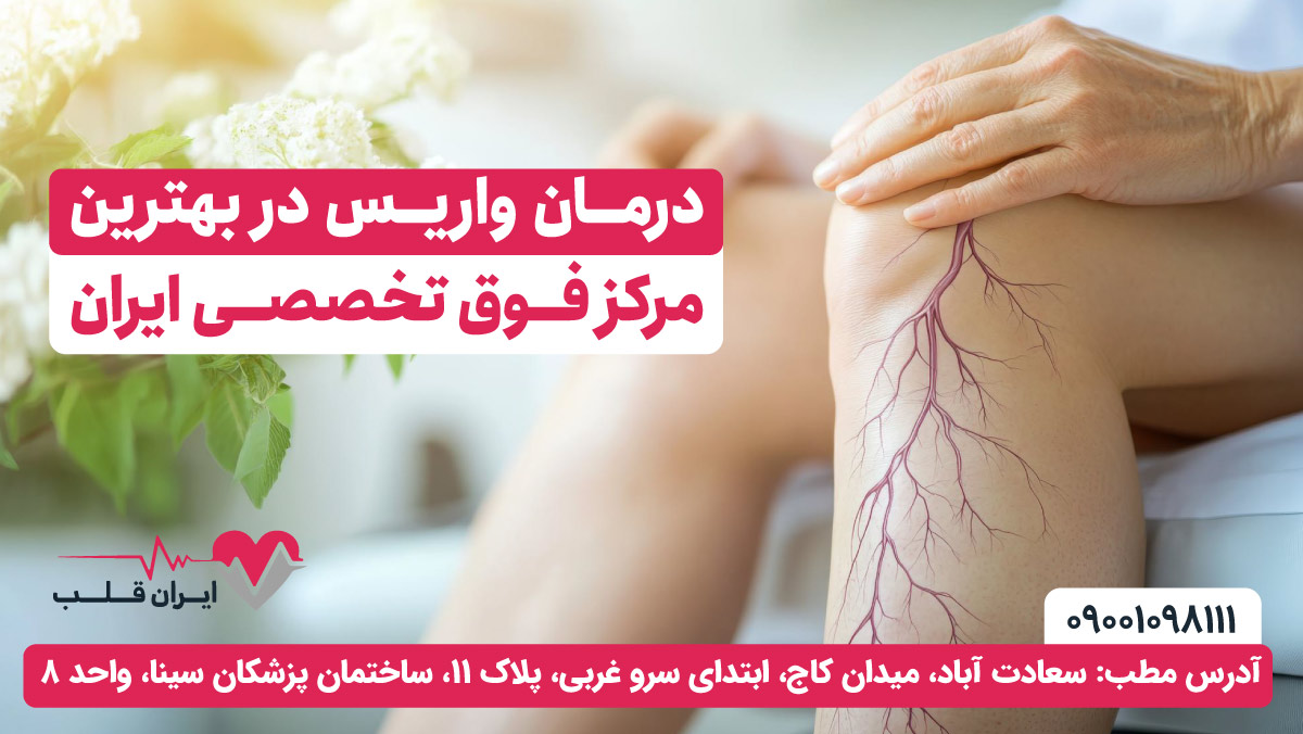 درمان واریس در کمترین زمان  با بهترین متخصص واریس