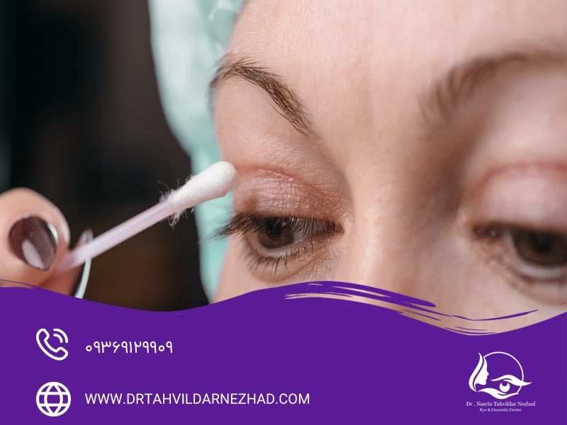 علت کوچک شدن چشم بعد از عمل بلفاروپلاستی چیست؟