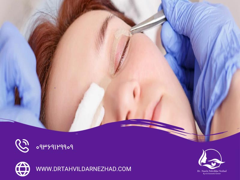 علت کوچک شدن چشم بعد از عمل بلفاروپلاستی چیست؟