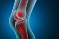 درمان پارگی مینیسک زانو با تمرینات ورزشی و حرکات اصلاحی