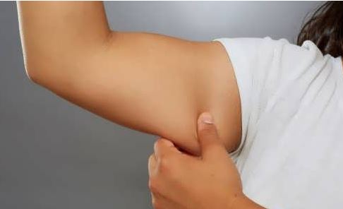 افتادگی بازو؛ روشهای عملی برای بهبود و فرمدهی افتادگی بازو؛ روشهای عملی برای بهبود و فرمدهی