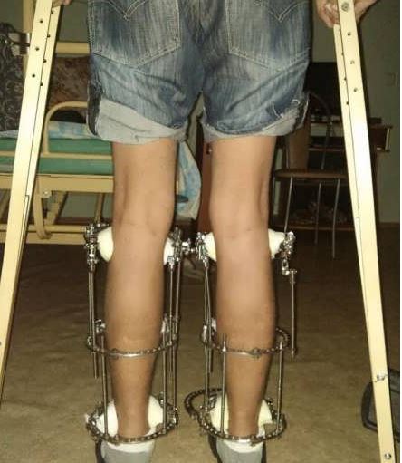 افزایش قد به طور طبیعی؛ نکات و روشهای موثر افزایش قد به طور طبیعی؛ نکات و روشهای موثر