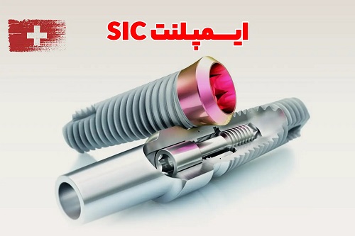 ایمپلنت سوئیسی SIC در تهران؛ تفاوتی که بعد از چند سال متوجه آن می‌شوید