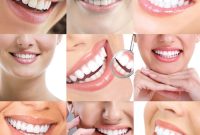 قبل از اصلاح طرح لبخند، این 7 اشتباه را مرتکب نشوید؛ راهنمای انتخاب دندانپزشک زیبایی در کرج قبل از اصلاح طرح لبخند، این 7 اشتباه را مرتکب نشوید؛ راهنمای انتخاب دندانپزشک زیبایی در کرج