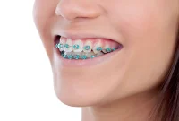 آیا ارتودنسی فقط جنبه زیبایی دارد؟ وقتی یک درمان، آینده سلامت دندان‌ها را تغییر می‌دهد